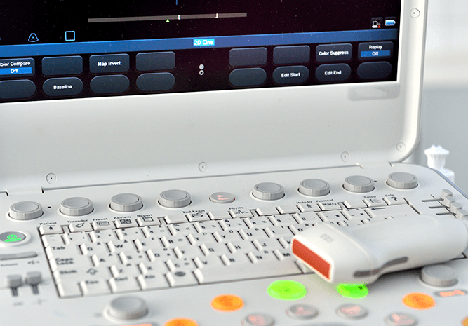 Ecocardiografie de stres