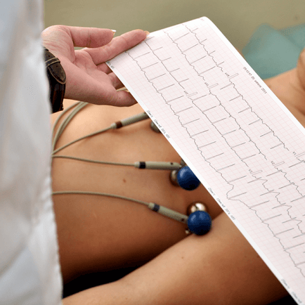 Monitorizare Holter EKG